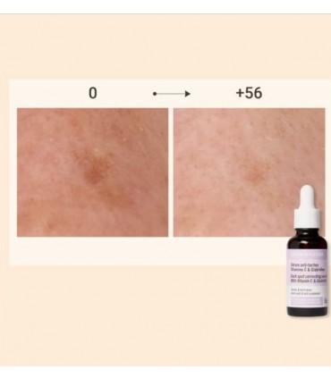 Oleoserum anti-pete Vitamina C si Glabridina